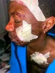 Man matchet daughters lover Father attacks daughter’s boyfriend with machete after catching them talking by the roadside, leaving the young man with wounds.